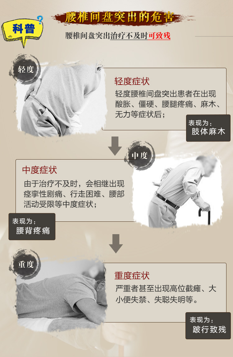 数字时代下的腰椎间盘突出治疗与预防探索，腰突在线